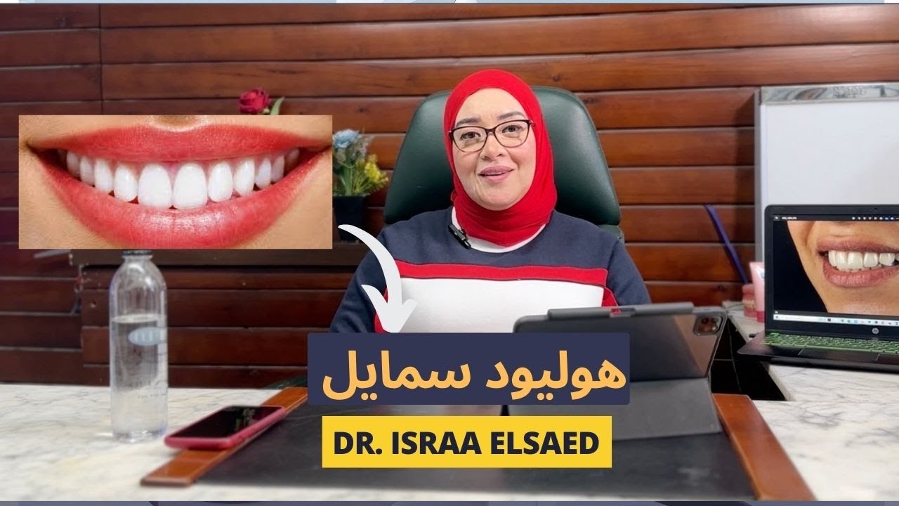 يعني ايه هوليود سمايل | دكتورة إسراء السعيد