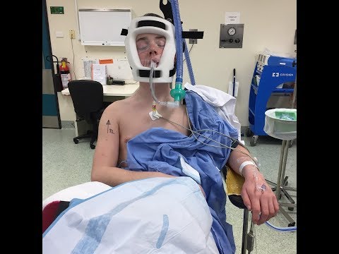 Uvelechenie suso nang walang surgery Dibdib pagpapalaki para sa UNP