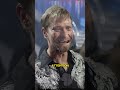 The Heartbreaking Disappearance of Kevin Skinner From America’s Got Talent #hollywood  #shorts