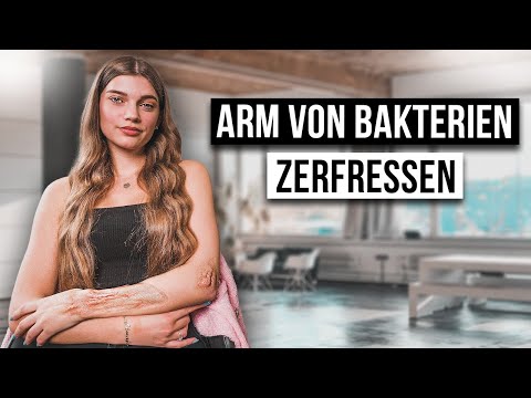 Wie ist das MORBUS CROHN ZU HABEN?