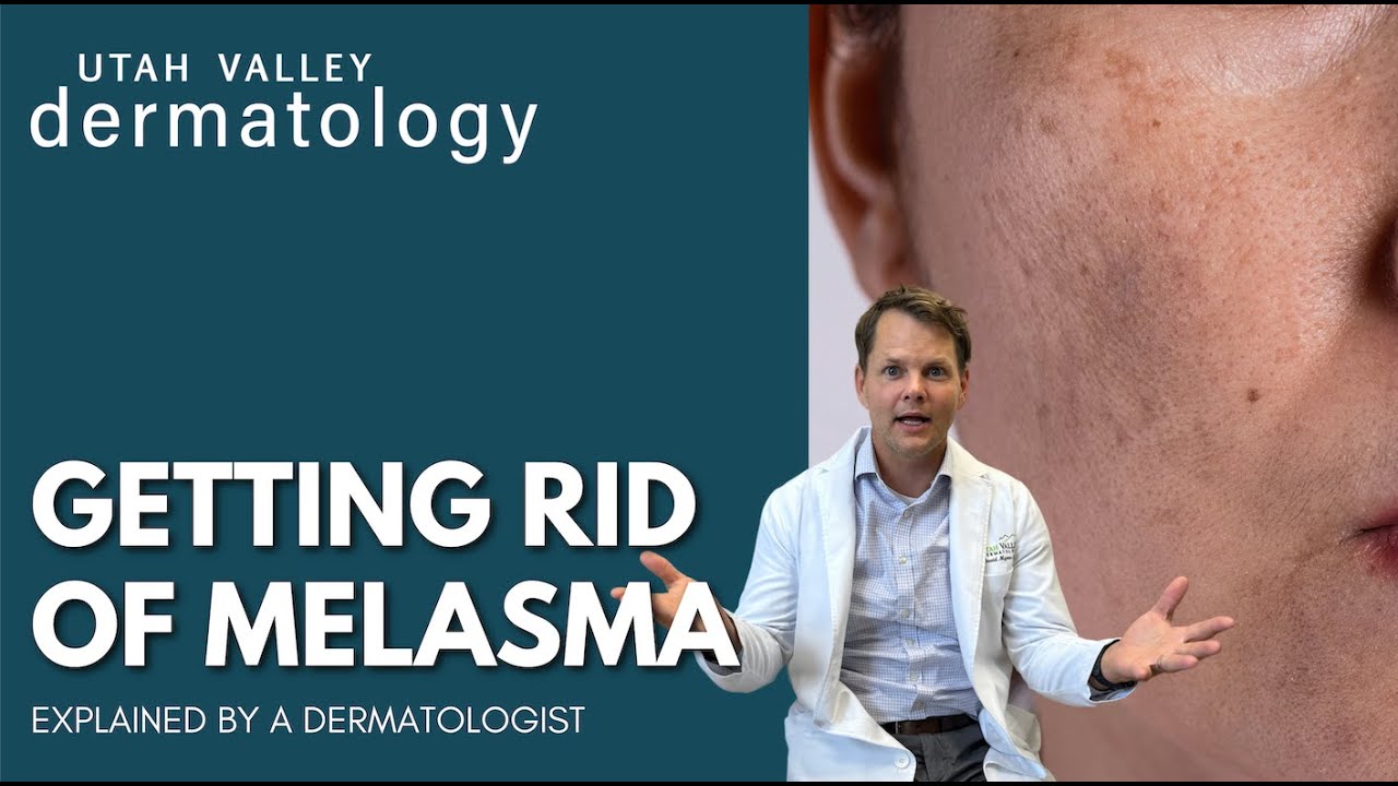Getting Rid of Melasma | Utah Valley Dermatology