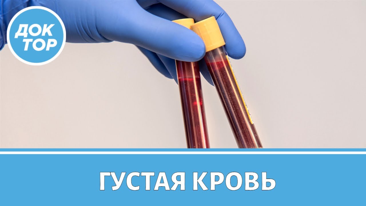 Густая кровь: как определить и что делать