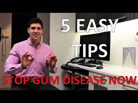HOW TO STOP GUM DISEASE AND BLEEDING AT HOME (Fix Gingivitis And Gum Pain, 5 Simple Steps)