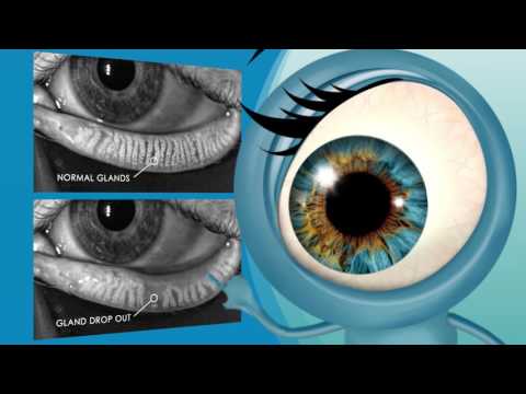 Dry Eye or MGD Doc by Tear Science