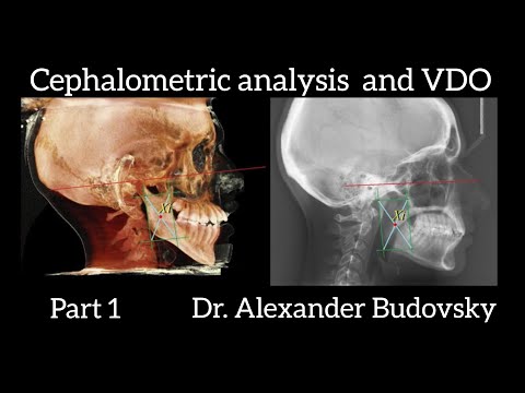 How to Determine Vertical Dimension of Occlusion (VDO, OVD). Cephalometric analysis. Part 1