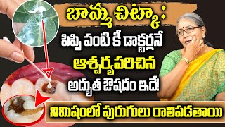 Download lagu బామ్మ చిట్కా : పిప్పి పంటి కీ డాక్టర్లనే ఆశ్చర్యపరిచినఅద్బుత ఔషదం ఇదే! | To Cure Cavities Naturally mp3 Download lagu బామ్మ చిట్కా : పిప్పి పంటి కీ డాక్టర్లనే ఆశ్చర్యపరిచినఅద్బుత ఔషదం ఇదే! | To Cure Cavities Naturally mp3