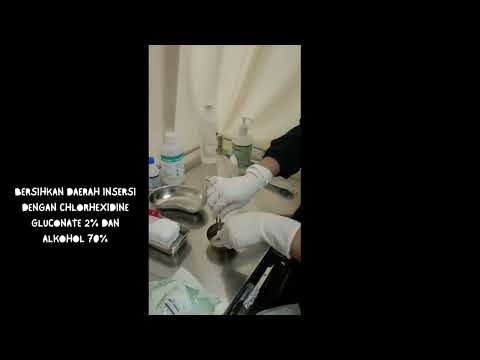 Perawatan CVC menggunakan chlorhexidine 2% dan alkohol 70%