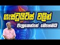ගැස්ට්රයිටිස් වලින් වැලකෙන්නේ මෙහෙමයි | Piyum Vila | 13 - 07 - 2020 | Siyatha TV ගැස්ට්රයිටිස් වලින් වැලකෙන්නේ මෙහෙමයි | Piyum Vila | 13 - 07 - 2020 | Siyatha TV
