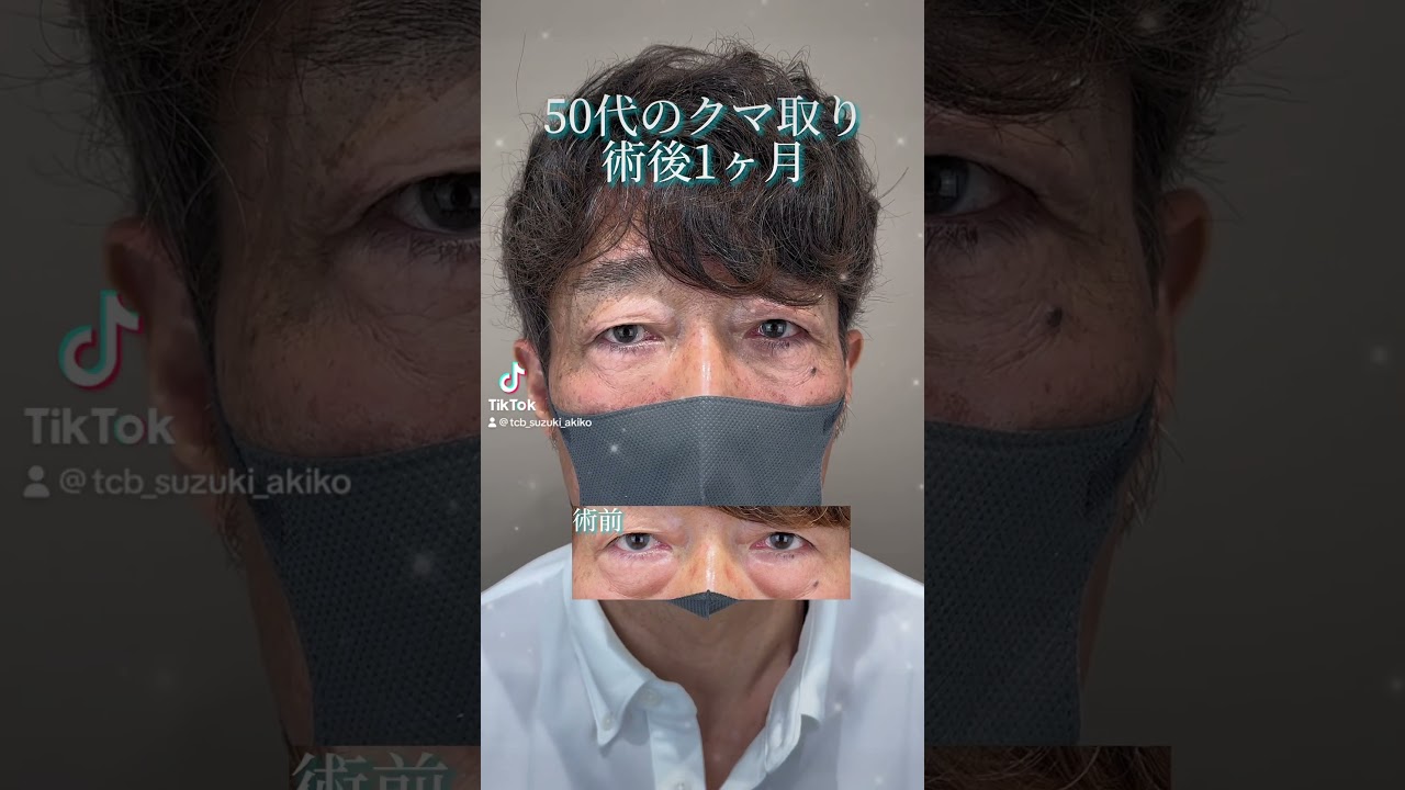 Youtubeのサムネイル