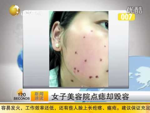 點痣改運ptt