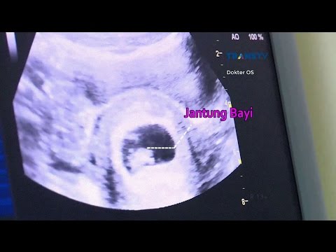 download lagu mp3 mp4 Tips Menjaga Kehamilan 2 Bulan, download lagu Tips Menjaga Kehamilan 2 Bulan gratis, unduh video klip Tips Menjaga Kehamilan 2 Bulan