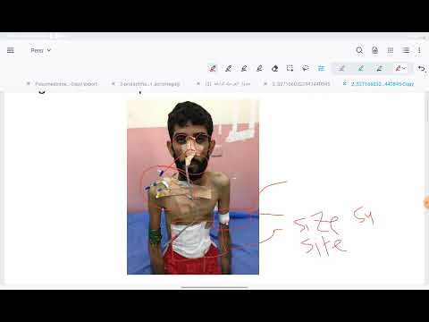 surgical exam ( general look )