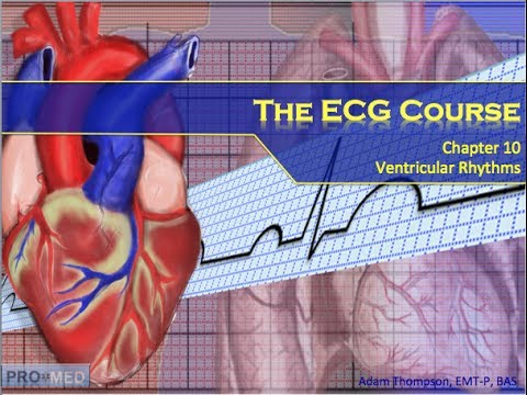 The ECG Course - Ventricular Rhythms