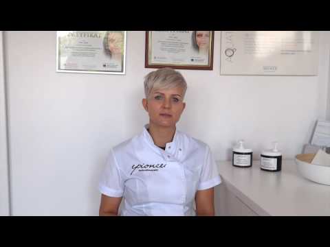 Jak usunąć przebarwienia na twarzy?