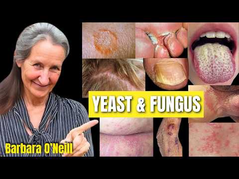 🔥 OBLITERATE Yeast & Fungus USE Barbara O'Neill's 1 WEIRD 🚨 Trick (Hidden Causes Exposed)