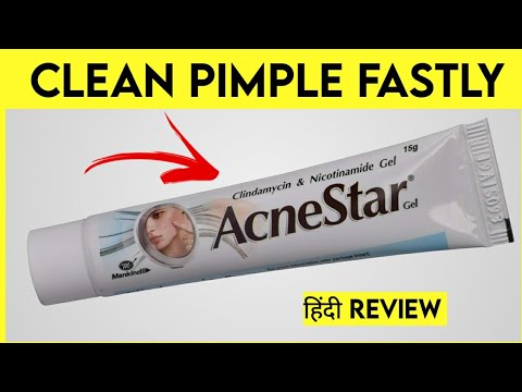 Acne Star Gel | Good for Pimple | Review Video
