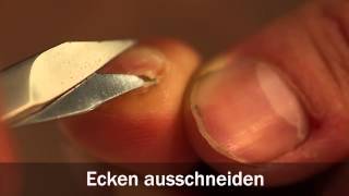 Wie Kann Man Fussnagel Weicher Machen Gesundheit Und Medizin 