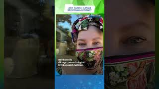 Penyanyi Terkenal Sia Alami Penyakit Spektrum Autisme, Apa Itu dan Bagaimana Mengatasinya?