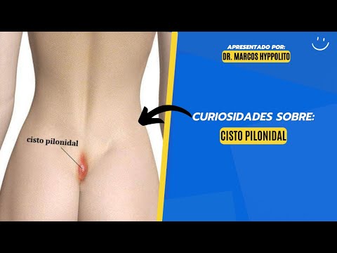 Marcos Hyppolito-14