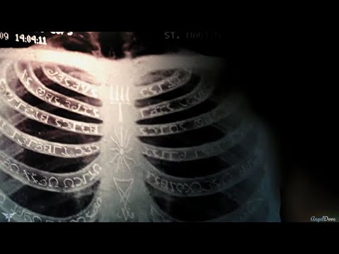 Team Free Will - Bones [ Imagine Dragons ]  [Angeldove]