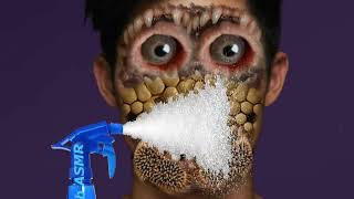 ASMR face needs worms and maggots cleaning | ASMR infected face treatment