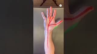 Numbness and tingling in the pinky finger is caused by THIS