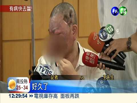 紅斑腫塊"蔓延" 上百顆掛鼻子