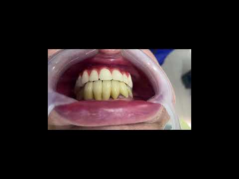 Mauricio Orlando Gutierrez Toro-60