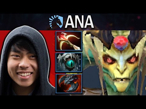 Medusa Dota 2 Gameplay RNG.Ana with 1021 GPM and Daedalus #dota #dota2