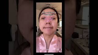 Download lagu what ACTUALLY worked for my hormonal acne! mp3