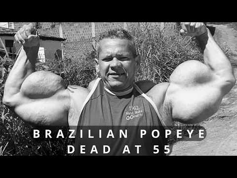 He Injected Oil Into His Arms and Became Famous: The Tragic Story of the Brazilian Popeye