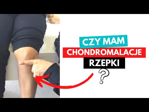 CHONDROMALACIA OF THE PATTERN - DAMAGE TO THE KNEE JOINT CARTILAGE - TOP 3 TESTS!