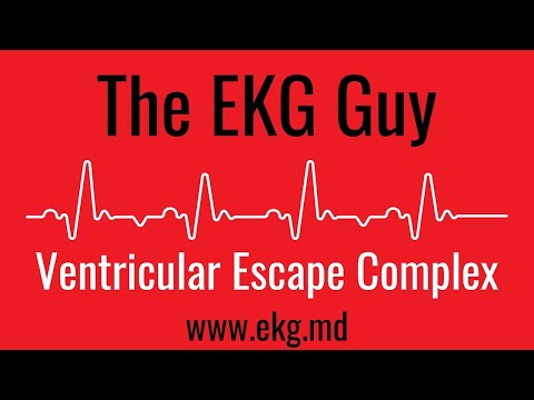 Ventricular Escape Complex EKG l The EKG Guy - www.ekg.md