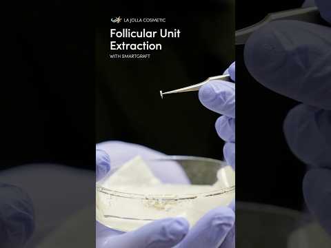 Precision in Action: Up Close with Follicular Unit...
