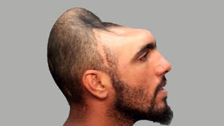 15 Times People Were Incredibly Lucky