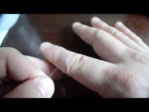 Damaged Infected Finger At Home Repair Video  (Disgusting)