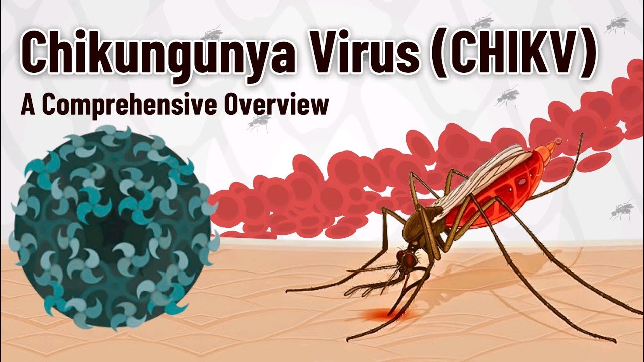 Chikungunya Virus (CHIKV) - A Global Threat | Mosquito-Borne Illness You've Probably Never Heard Of