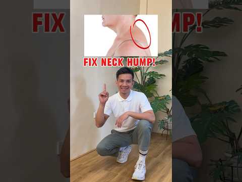FIX NECK HUMP THE PROPER WAY 🤩🤩🤩#neckstretch #posturecorrection #neckhump