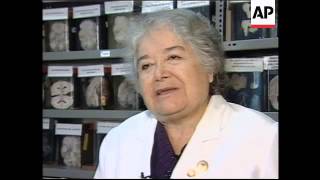 Brain museum in Lima is macabre but interesting