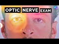 Optic Nerve Assessment | CN II | OSCE Clip | UKMLA | CPSA | PLAB 2