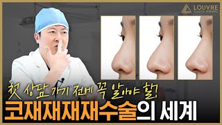 코 수술 최종_최최종_찐최종_진짜최최최종 이제 그만! 10차 코 재수술까지 해본 의사의 솔직한 이야기