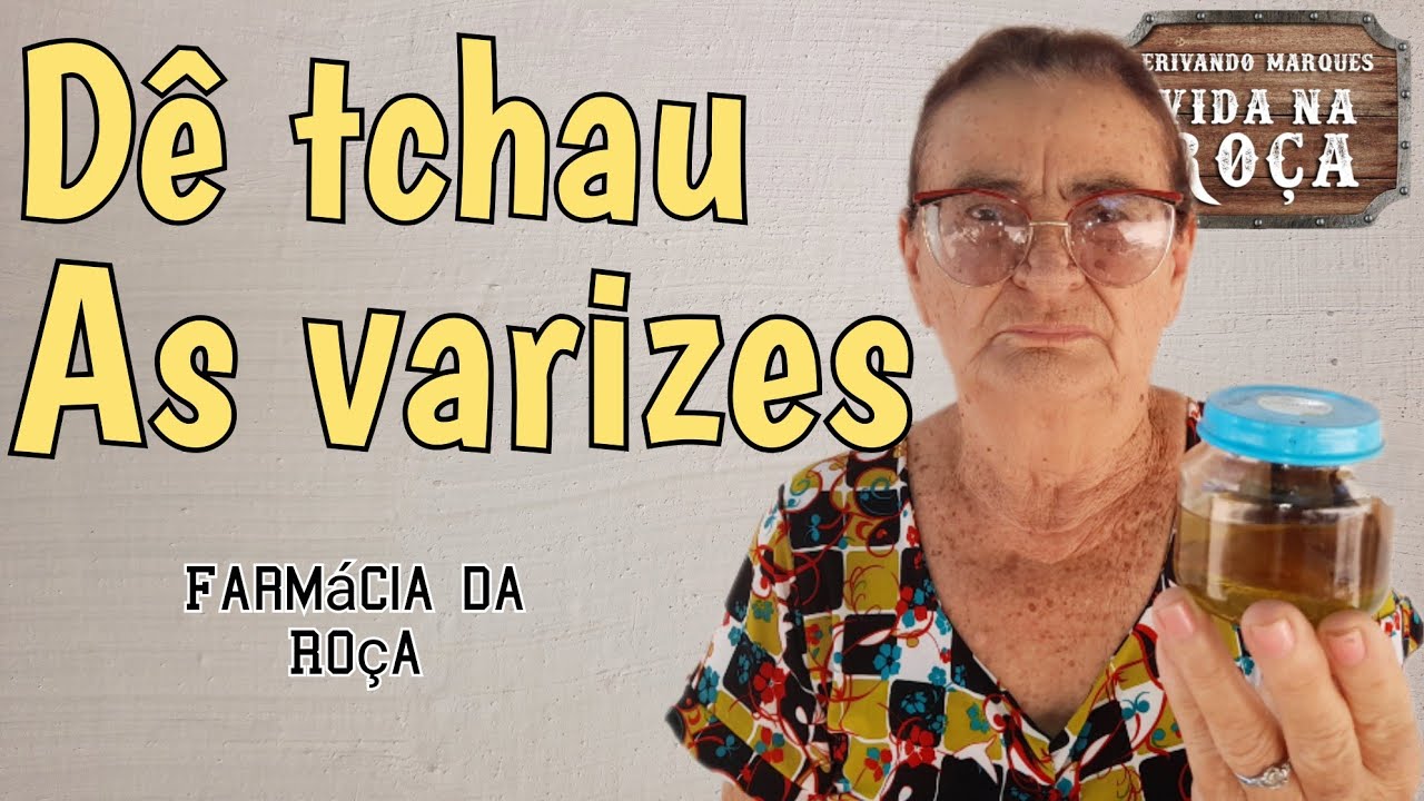 Acabe com as varizes com essa receitinha da vó Dalva.