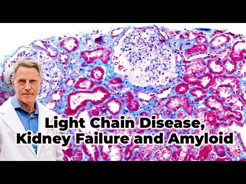 Light Chain Disease, Kidney Failure and Amyloid -FORD BREWER MD MPH