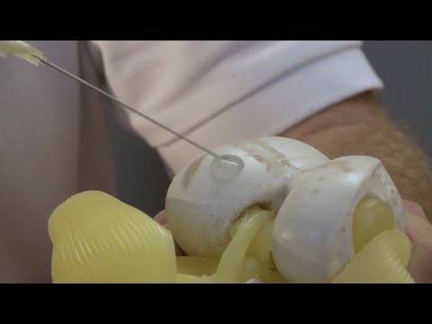 Arthrose des Kniegelenks Übungen Diät Vitaphone Behandlung von Hüft-