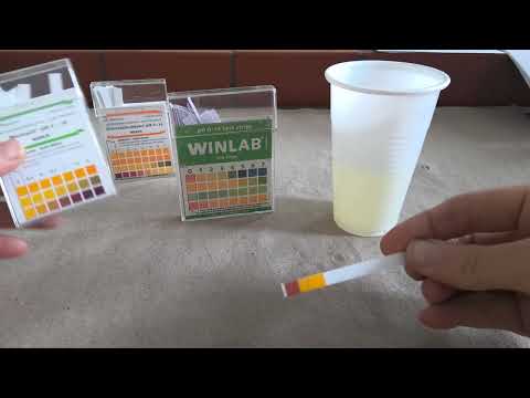 PH-Wert des Urins mit Teststreifen überprüfen