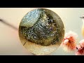 Giant Ear Wax Removal Perfect Ear Cleaning With Relaxing Music