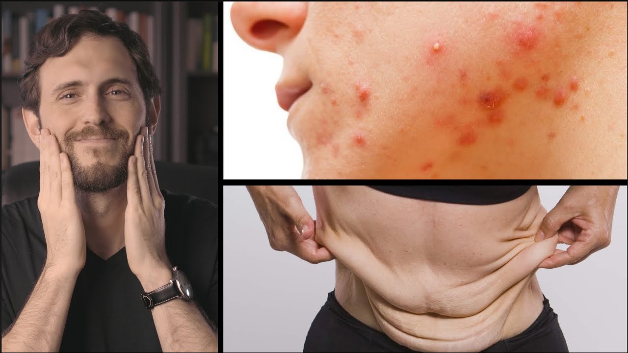 ¿Cómo tener una PIEL SIN ACNÉ ni FLACIDEZ? (ayuno intermitente, arrugas y suplementos)