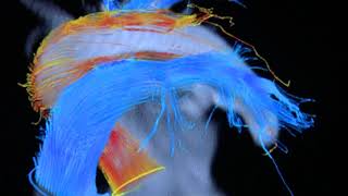 Watch a heart in 4D
