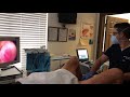 Rezūm Procedure With South Florida Leading Urologist Dr Mike Zahalsky