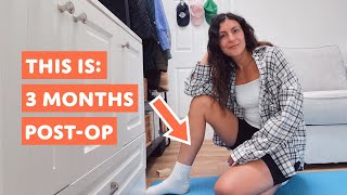 Achilles Tendon Rupture | 12 weeks post-op check in – Part 13